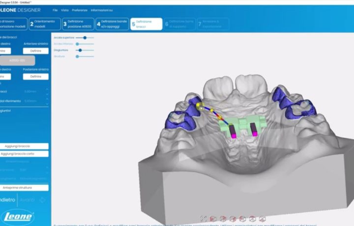 3D Designer Leone predstavuje spojenie tradície a budúcnosti ortodoncie