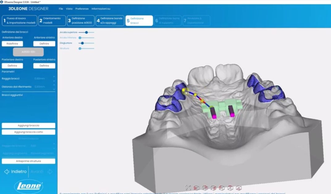 3D Designer Leone predstavuje spojenie tradície a budúcnosti ortodoncie